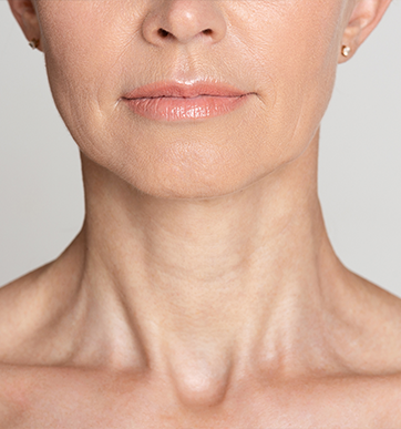 A Reason to Be Thankful: Turkey Neck Treatments that Work - California Skin  Institute